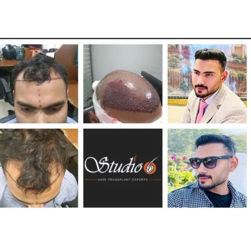 Untitled design - 2024-11-26T170512.620